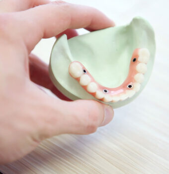 Masuri pentru a va asigura ca dintii copilului dumneavoastra se dezvolta corect